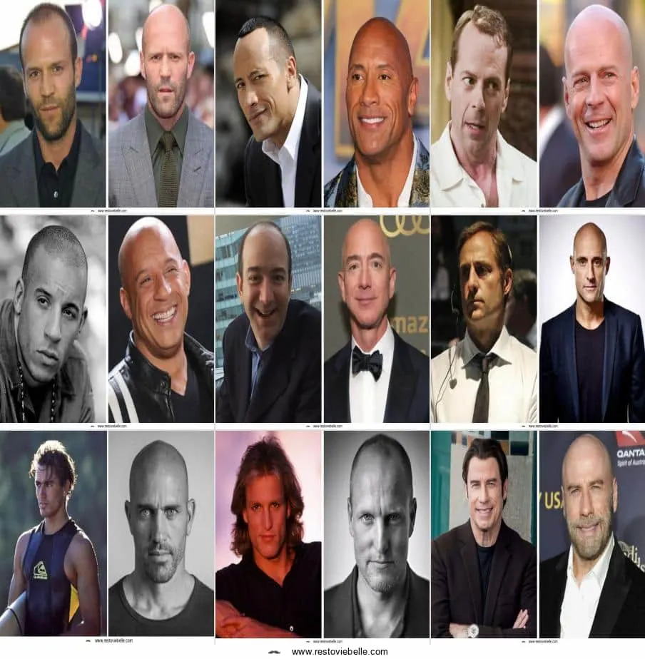 Bald Celebrities Before and After Bald