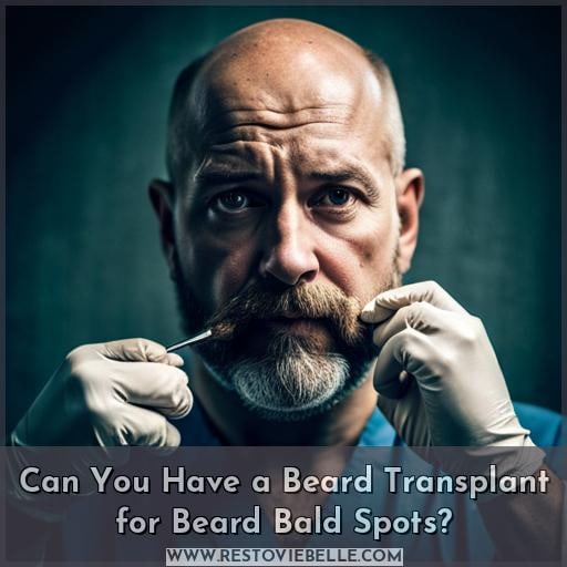 Can You Have a Beard Transplant for Beard Bald Spots