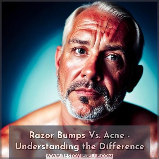 Razor Bumps Vs. Acne - Understanding the Difference