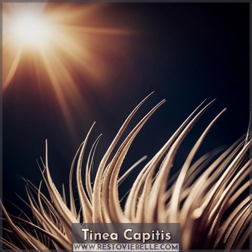 Tinea Capitis