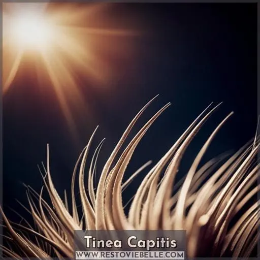 Tinea Capitis