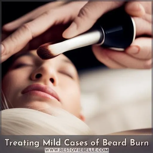 Treating Mild Cases of Beard Burn
