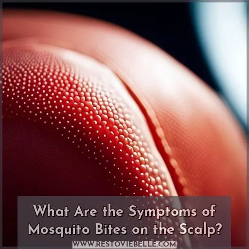 What Are the Symptoms of Mosquito Bites on the Scalp