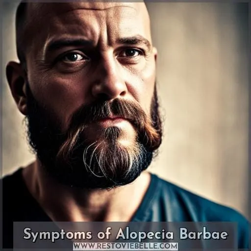 Symptoms of Alopecia Barbae