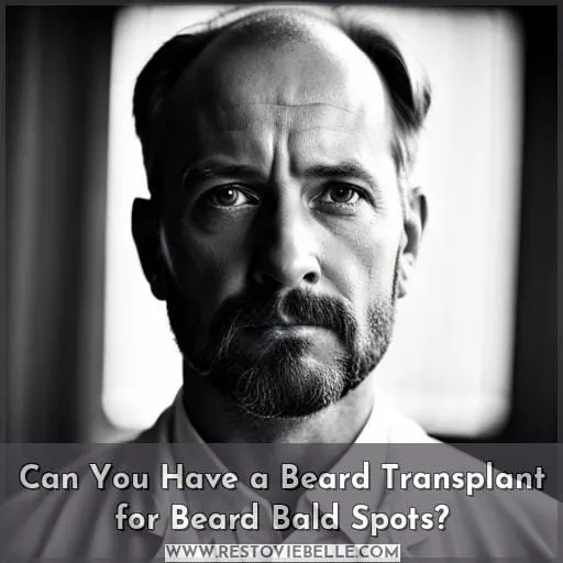 Can You Have a Beard Transplant for Beard Bald Spots