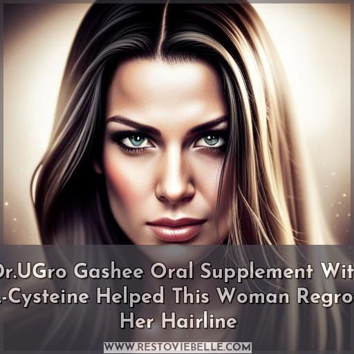 Dr.UGro Gashee Oral Supplement With L-Cysteine Helped This Woman Regrow Her Hairline Dr.UGro Gashee Oral Supplement With L-Cysteine Helped This Woman Regrow Her Hairline