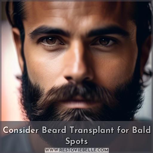 Consider Beard Transplant for Bald Spots