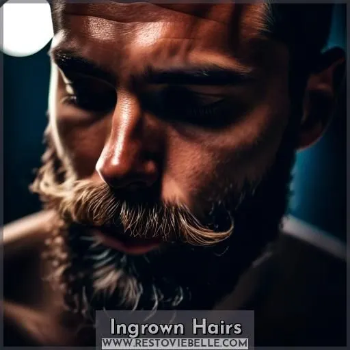 Ingrown Hairs