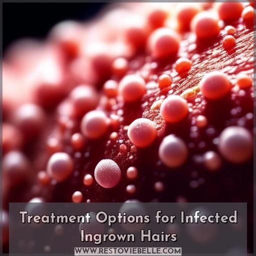Treatment Options for Infected Ingrown Hairs
