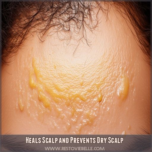 Heals Scalp and Prevents Dry Scalp Heals Scalp and Prevents Dry Scalp