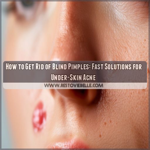 how to get rid of blind pimple how to get rid of blind pimple
