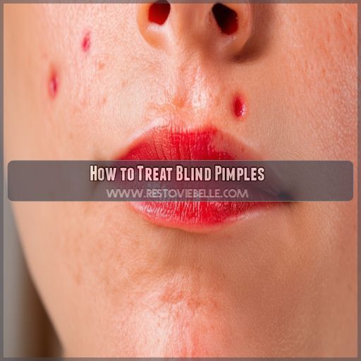 How to Treat Blind Pimples How to Treat Blind Pimples