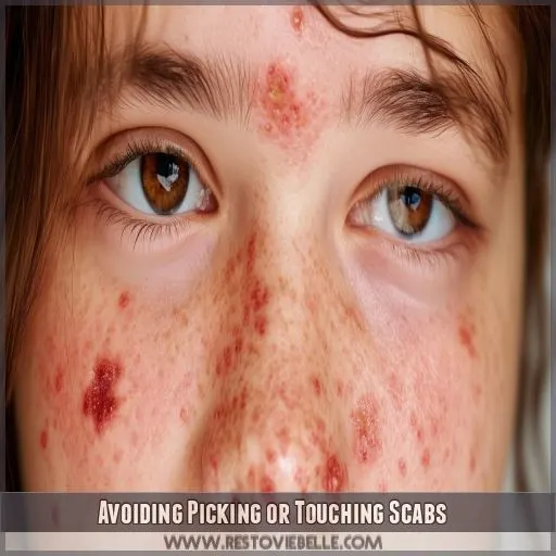 Avoiding Picking or Touching Scabs