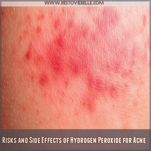 Risks and Side Effects of Hydrogen Peroxide for Acne Risks and Side Effects of Hydrogen Peroxide for Acne
