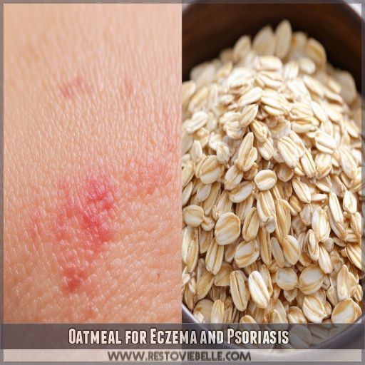 Oatmeal for Eczema and Psoriasis Oatmeal for Eczema and Psoriasis