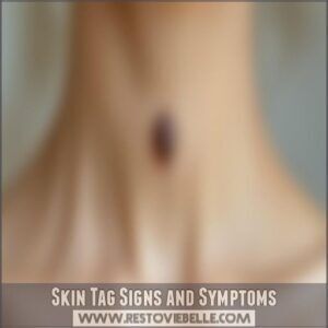 Skin Tag Signs and Symptoms
